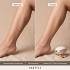 Asetics Petal 4-Head Hair Remover