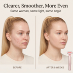 Asetics Radiance 4-in-1 Skincare Wand
